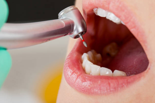 Reliable Wilton Manors, FL Emergency Dentist Solutions